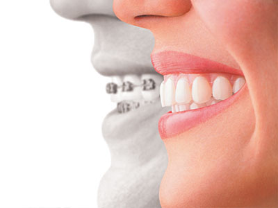 The image features a side-by-side comparison of a person s face with a dental implant on one side, highlighting the difference between natural teeth and an artificial tooth.